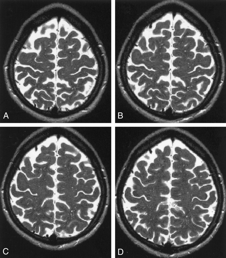 Fig 3.