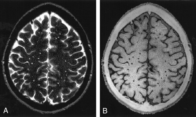 Fig 2.