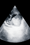 Fig 4 –
