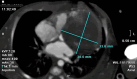 Fig 6 –