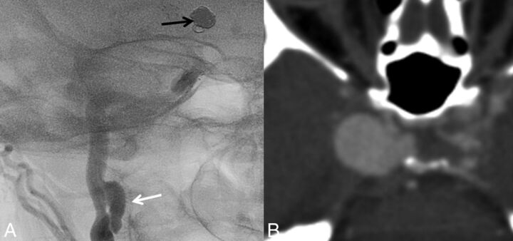 Fig 2.