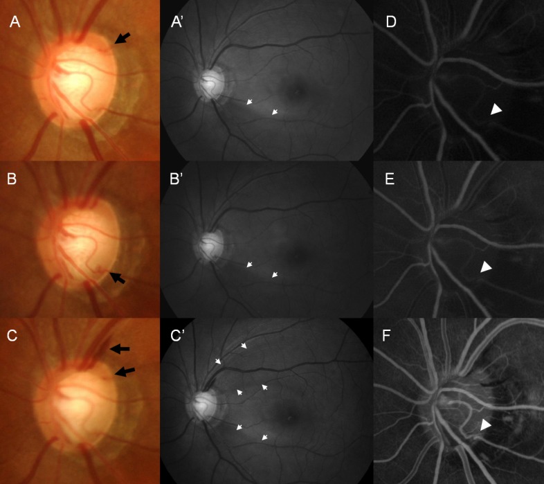 Fig 3