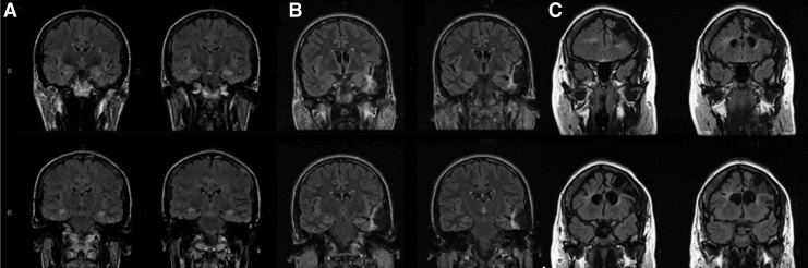 FIG. 1.