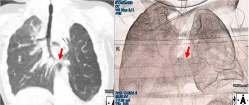 Fig. 5