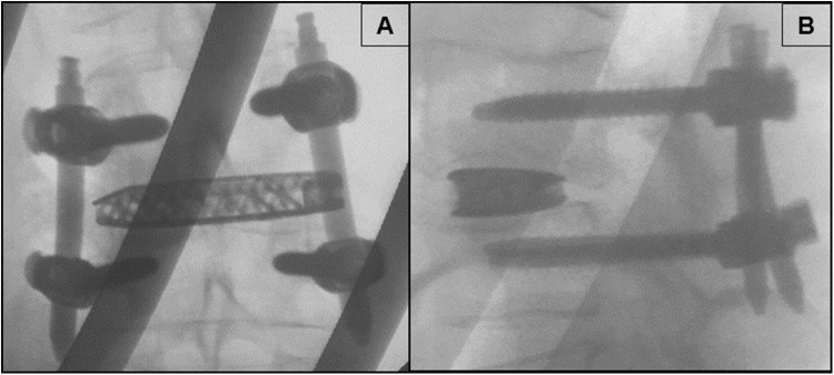 Fig. 4