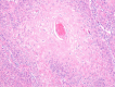Figure 23