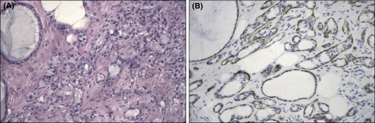 Figure 11.2