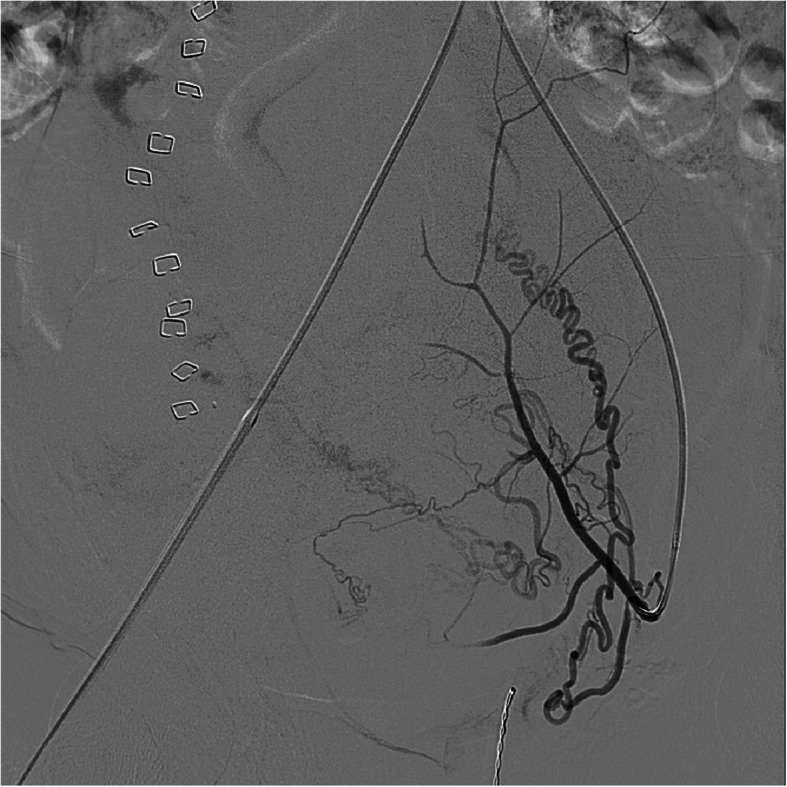 Fig. 3