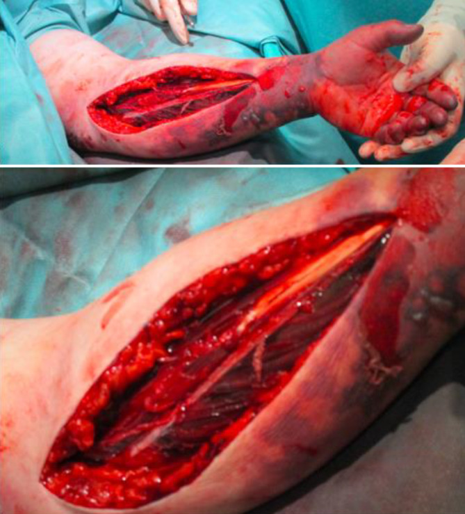 graphic file with name 772_2022_905_Fig2_HTML.jpg