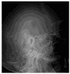 Figure 18
