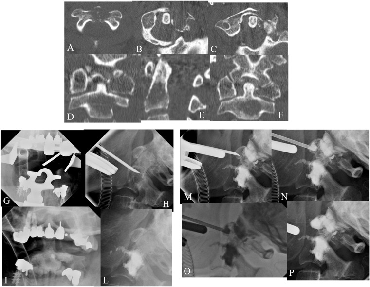 Figure 2.