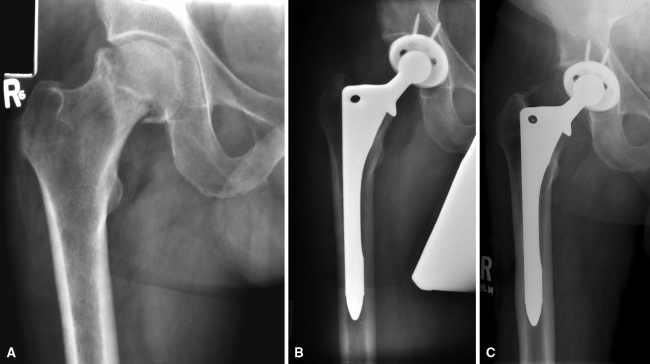 Fig. 2A–C