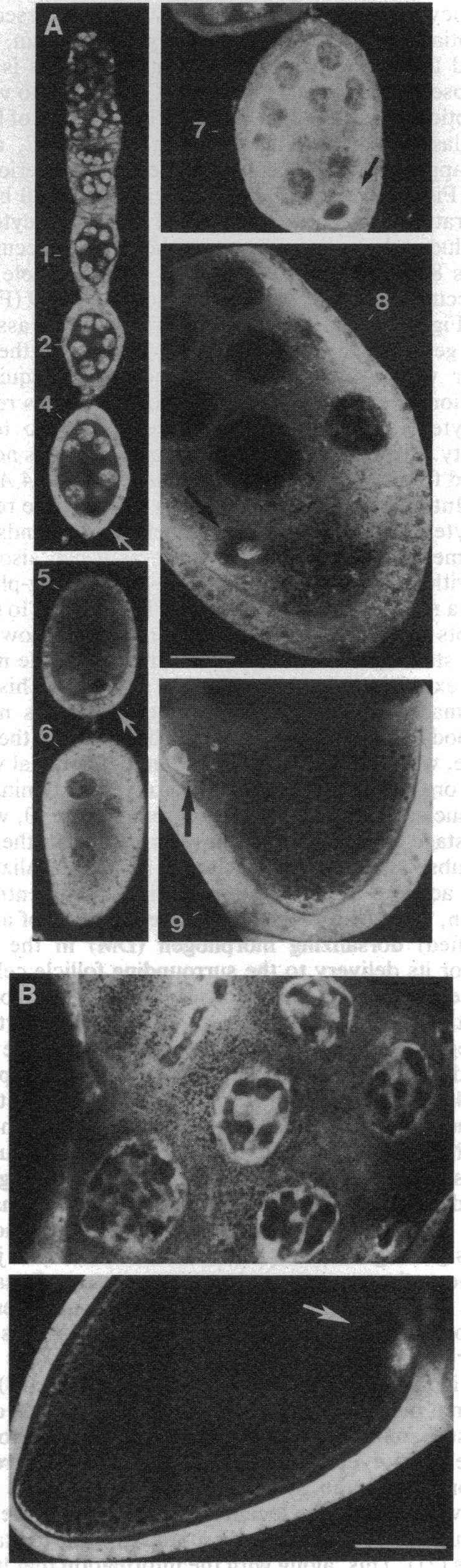 graphic file with name pnas01129-0415-a.jpg