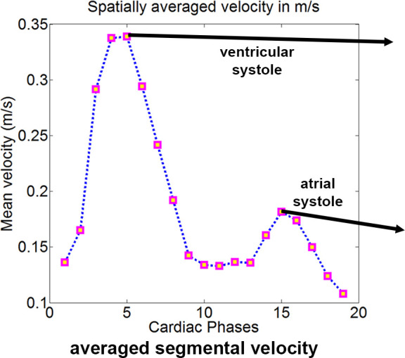 Figure 1e: