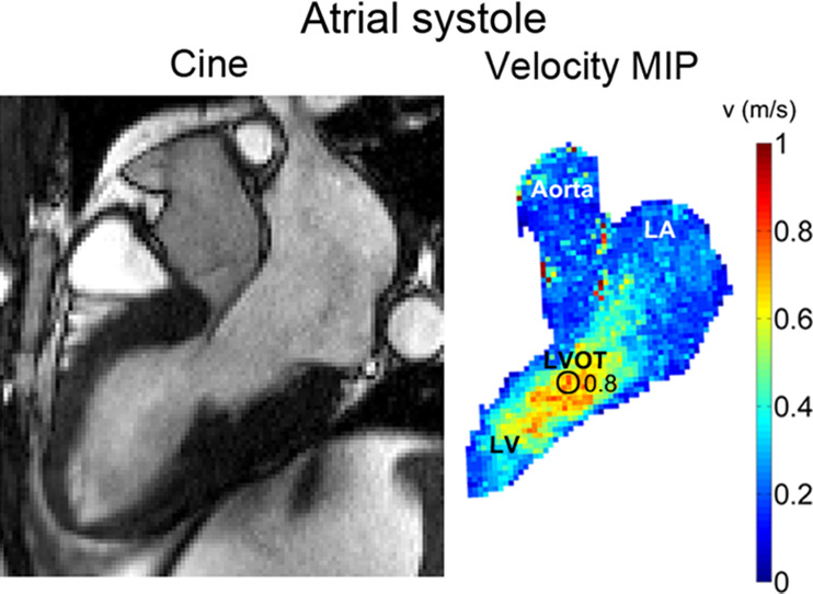 Figure 3b: