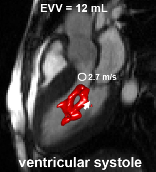 Figure 5a: