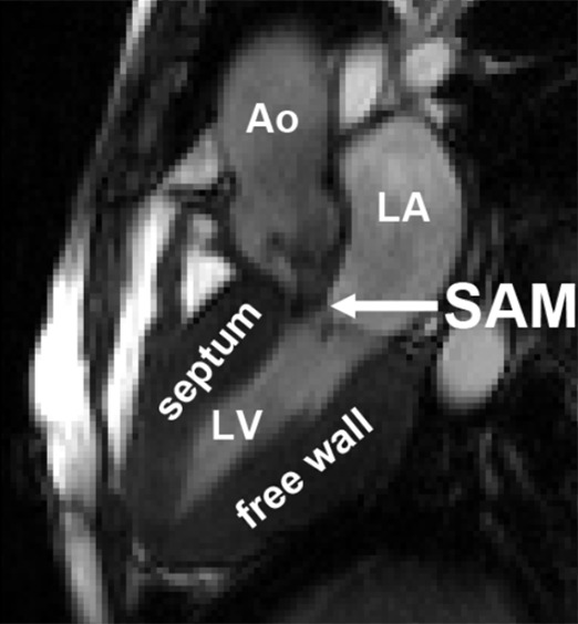 Figure 5c: