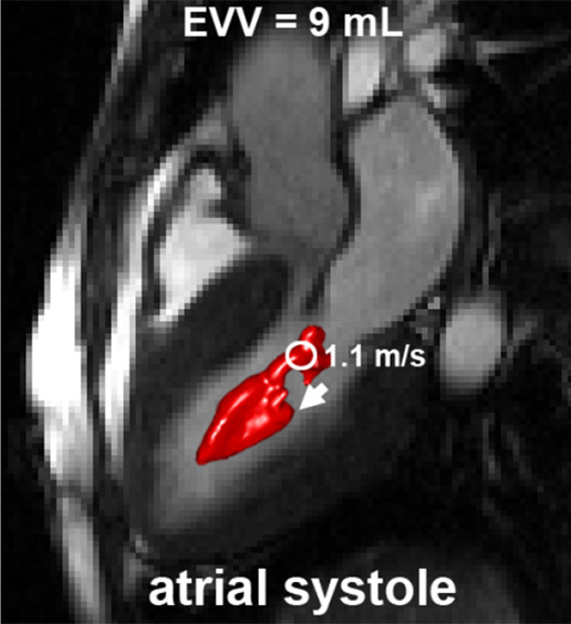 Figure 5b: