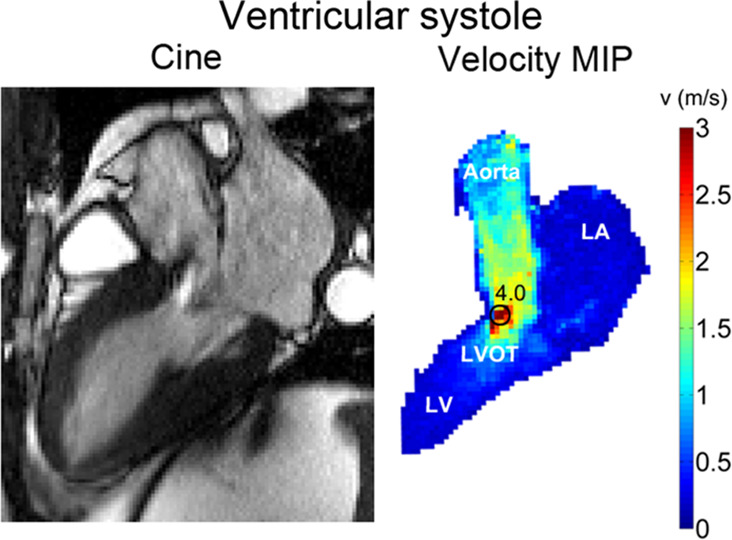 Figure 3a: