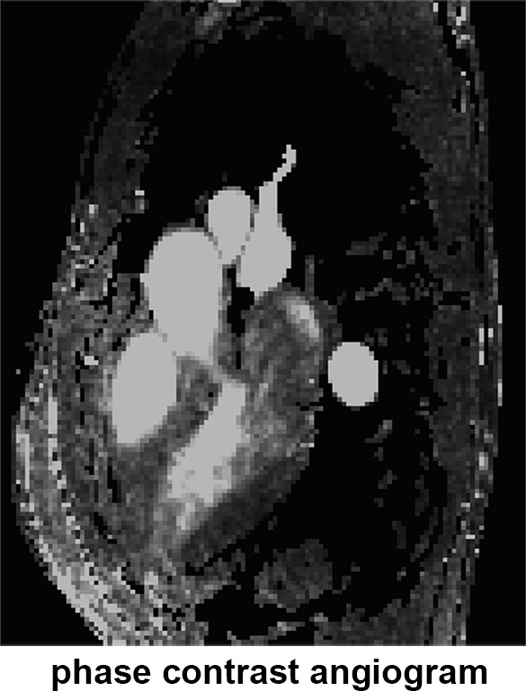 Figure 1b: