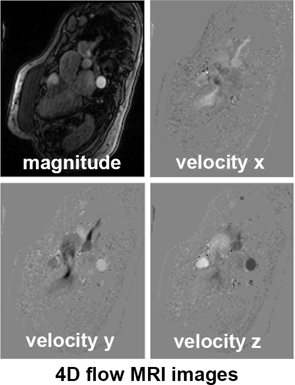 Figure 1a: