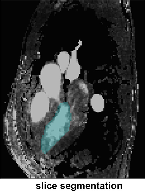 Figure 1c: