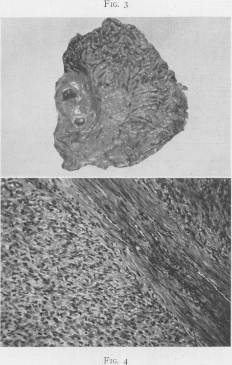 Fig. 3., Fig. 4.