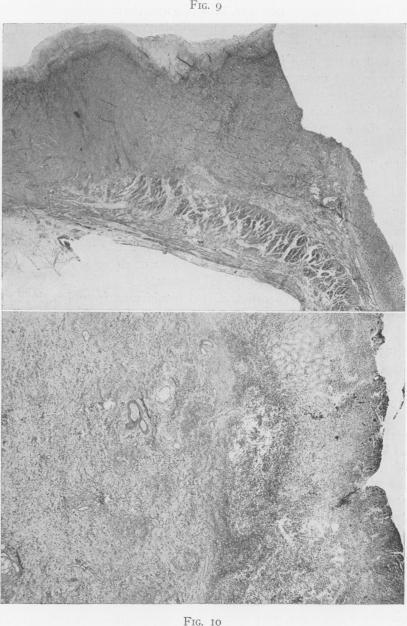 Fig. 9., Fig. 10.