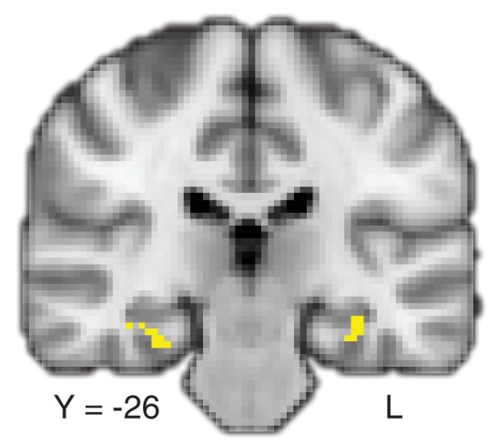 Figure 3—figure supplement 4.