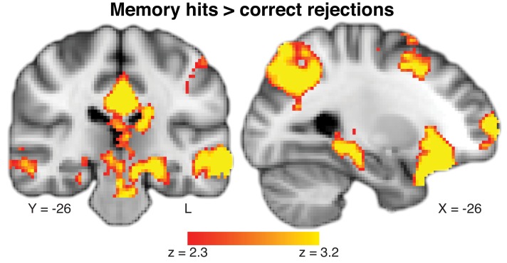 Figure 3—figure supplement 1.