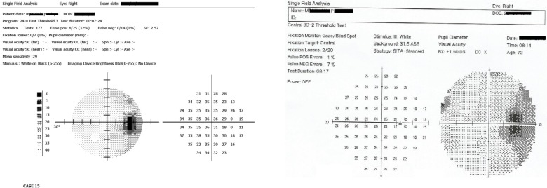 Figure 14