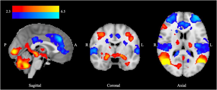 FIGURE 1