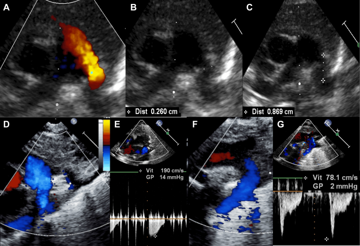 Figure 3