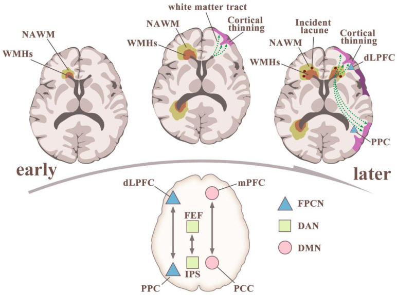 Role of White Matter Hyperintensities and Related Risk Factors in ...