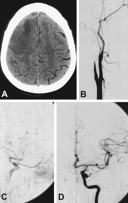 fig 2.