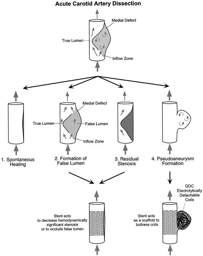 fig 1.