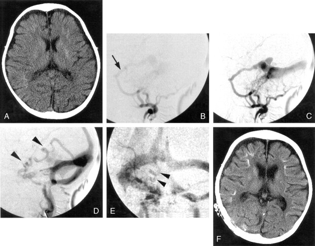 Fig 3.