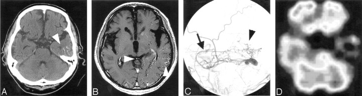 Fig 1.