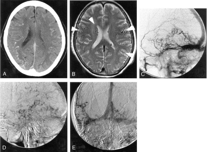 Fig 2.