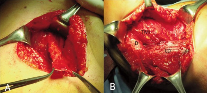 Figure 3 A, B.