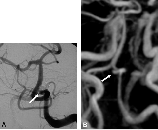 Fig 2.