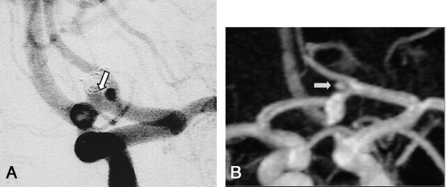 Fig 3.