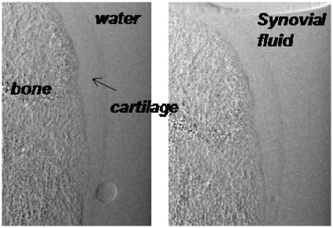 Fig. 11