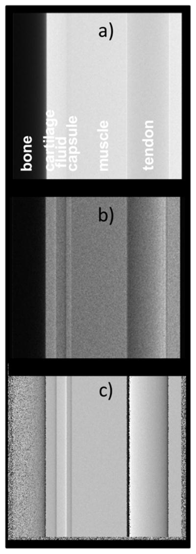 Fig. 16