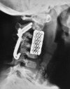 Fig. 10