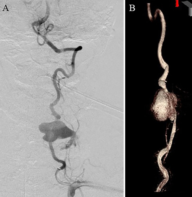 FIG. 2.