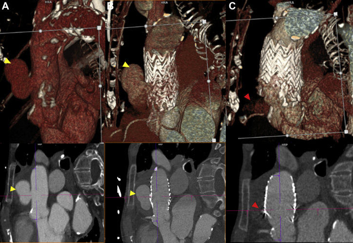 Fig 3