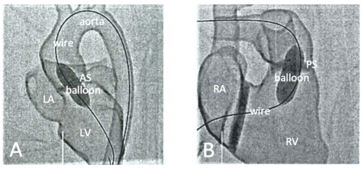 Figure 12