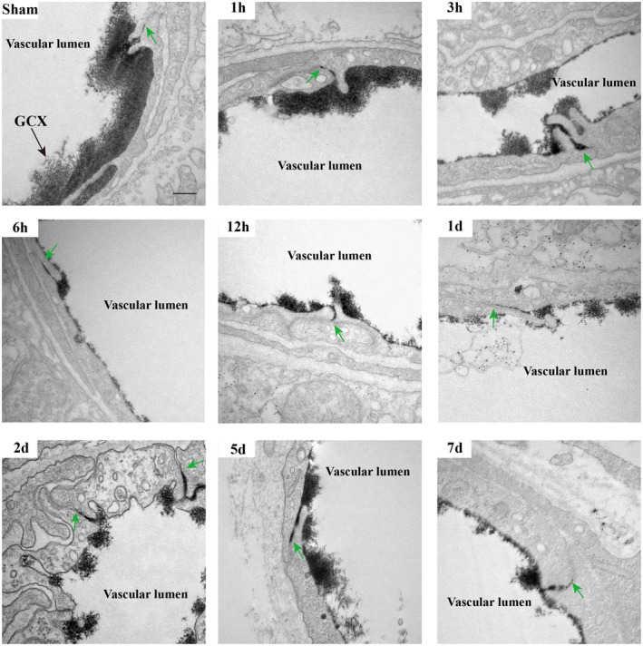 FIGURE 3