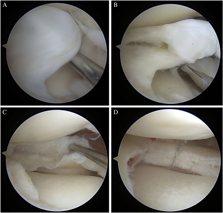 Fig. 5